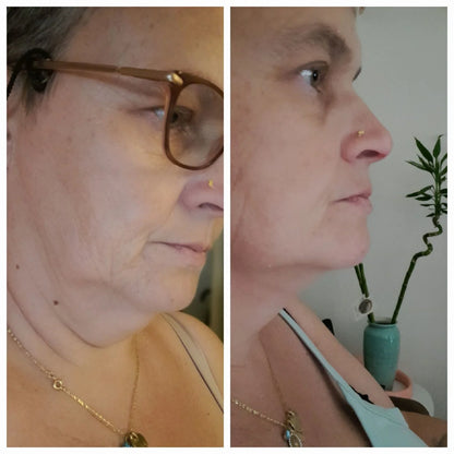 Gesichts-Konturierungs-Maske™